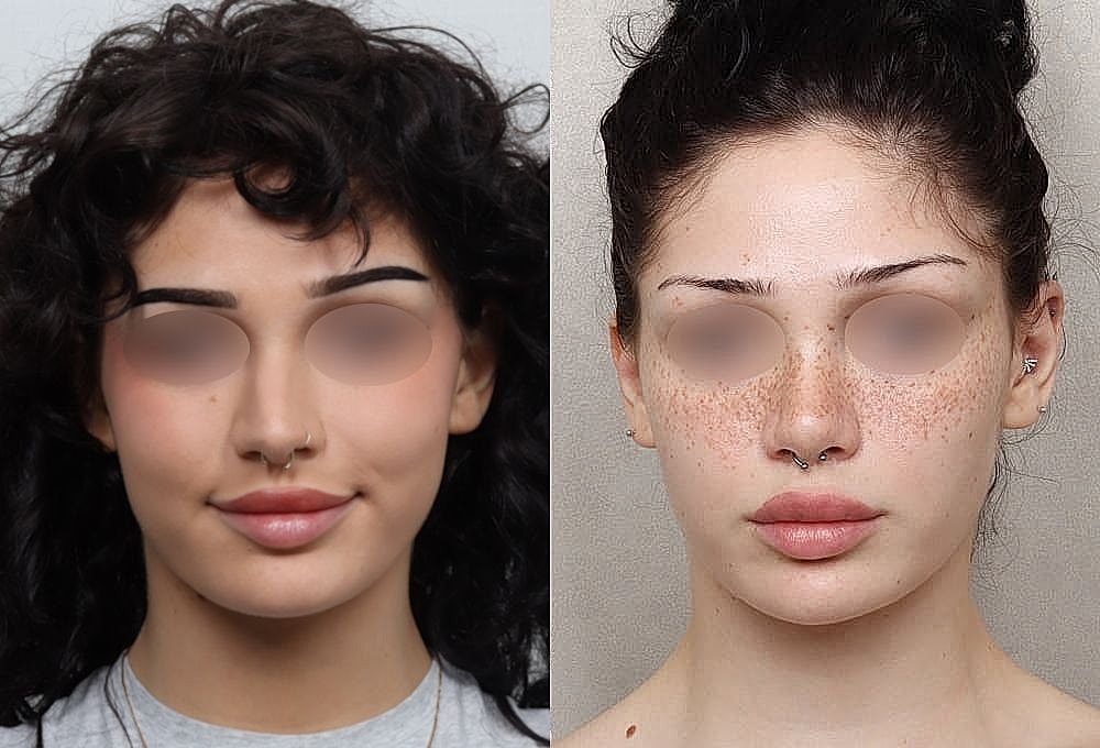 Before and after makeup transformation of a woman.