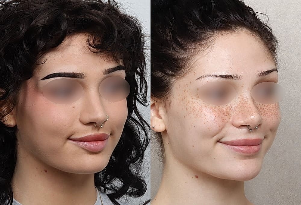 Before and after beauty transformation comparison.