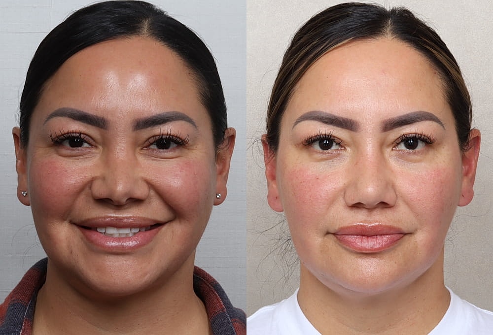 Before and after facial transformation comparison.