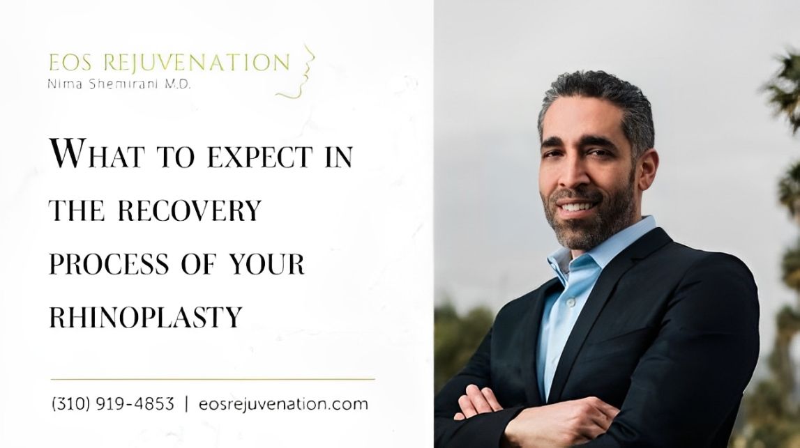 Rhinoplasty recovery tips and expectations from doctor.